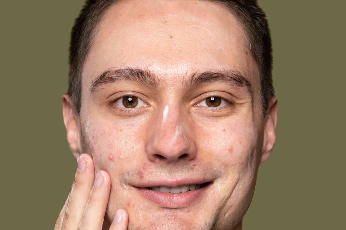 Pria yang kulitnya berjerawat