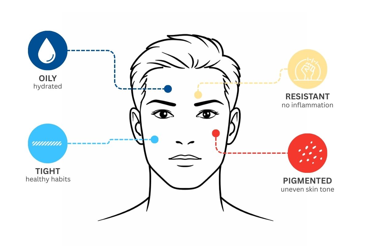 hiperpigmentasi setelah jerawatan