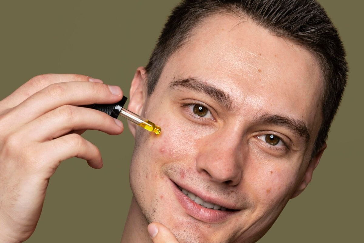 Pria mengaplikasikan serum di area yang terdampak jerawat