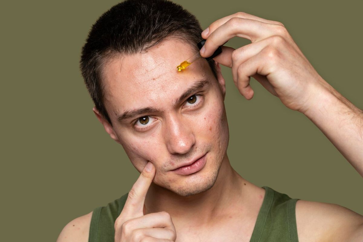 Pria memakai serum di dahinya