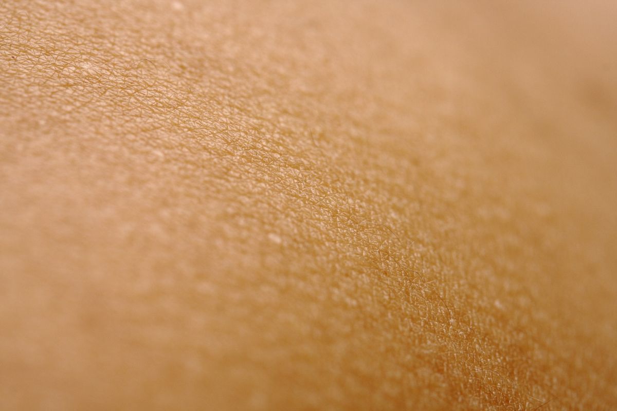 Tekstur kulit kering.