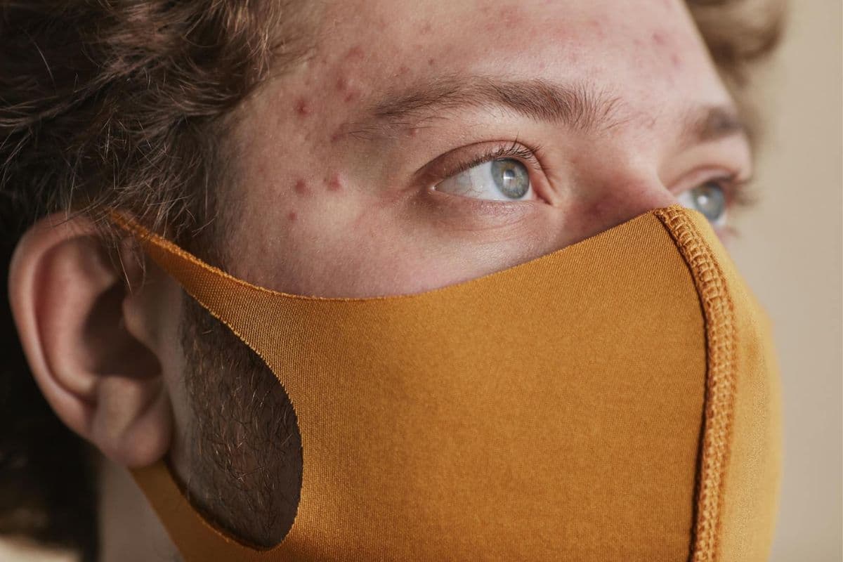 pria berjerawat memakai masker