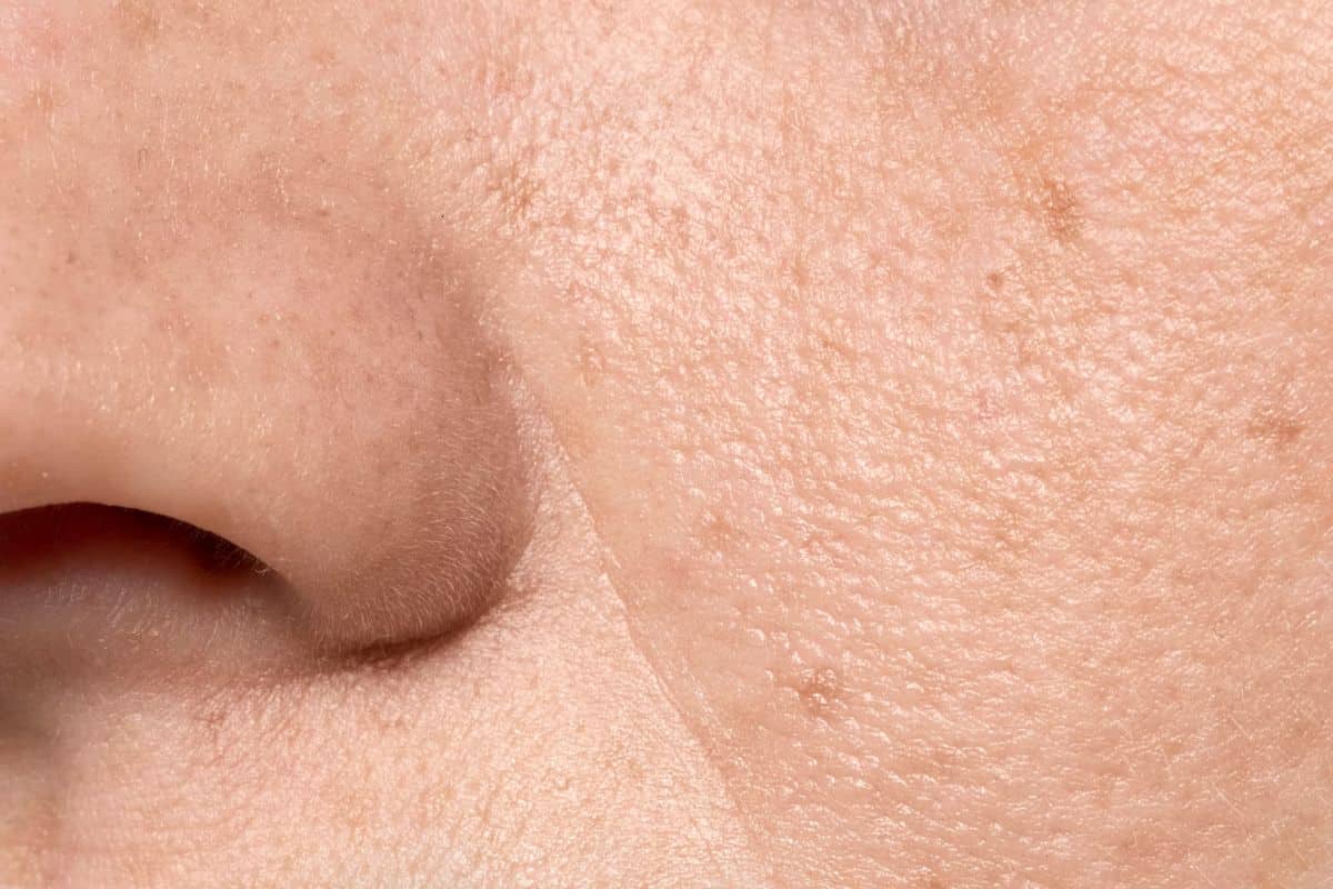 Tampak close-up kulit kering dan terdapat noda hitam